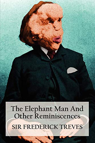 The Elephant Man and Other Reminiscences von Benediction Classics
