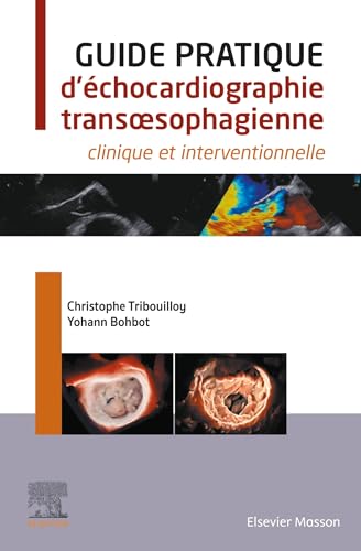 Guide pratique d'échocardiographie transoesophagienne: clinique et interventionnelle Guide pratique d'échocardiographie transoesophagienne: clinique et interventionnelle von MASSON