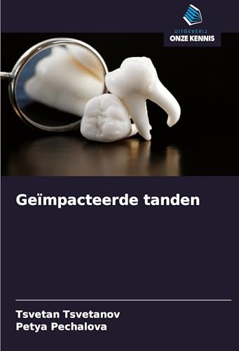 Geïmpacteerde tanden von Uitgeverij Onze Kennis