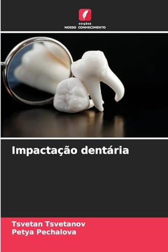 Impactação dentária von Edições Nosso Conhecimento