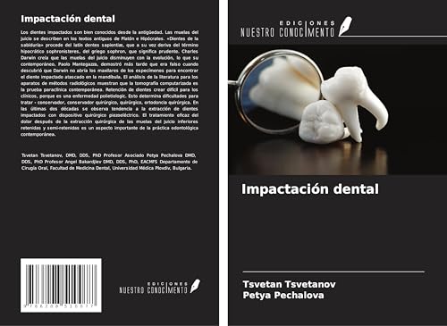 Impactación dental von Ediciones Nuestro Conocimiento