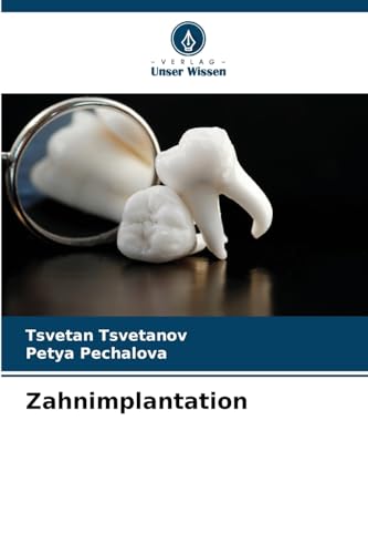 Zahnimplantation von Verlag Unser Wissen