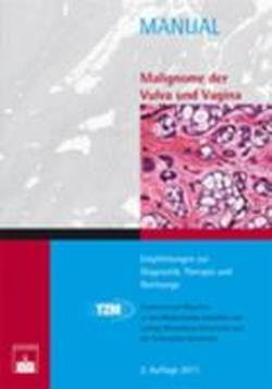 Malignome der Vulva und Vagina: Empfehlungen zur Diagnostik, Therapie und Nachsorge (Manuale Tumorzentrum München) von Zuckschwerdt