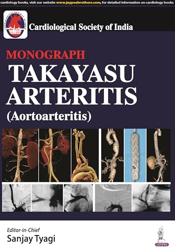 Takayasu Arteritis (Aortoarteritis) von Jaypee Brothers Medical Publishers