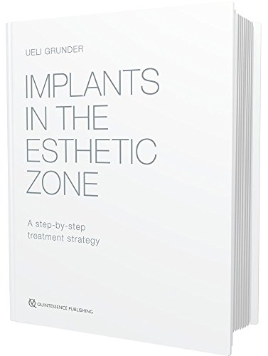 Implants in the Esthetic Zone: A step-by-step treatment strategy von Quintessence Publishing