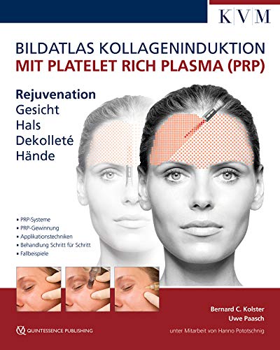 Bildatlas Kollageninduktion mit Platelet Rich Plasma (PRP): Rejuvenation Gesicht - Hals - Dekolleté - Hände