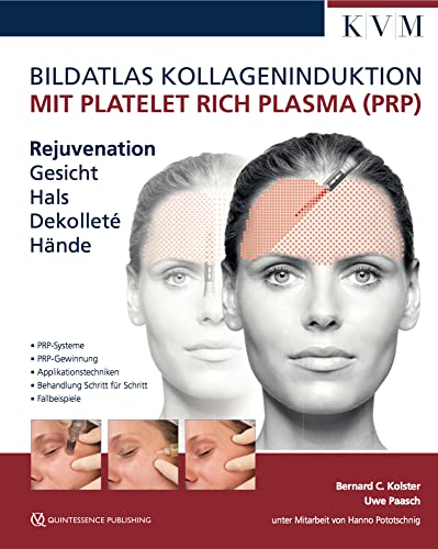 Bildatlas Kollageninduktion mit Platelet Rich Plasma (PRP): Rejuvenation Gesicht - Hals - Dekolleté - Hände von KVM-Der Medizinverlag