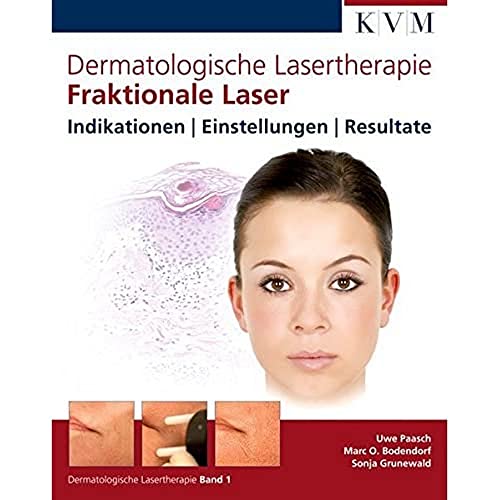 Dermatologische Lasertherapie Band 1: Fraktionale Laser: Indikationen - Einstellungen - Resultate von KVM Verlag