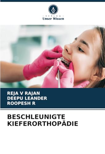 BESCHLEUNIGTE KIEFERORTHOPÄDIE: DE von Verlag Unser Wissen