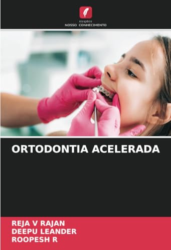 ORTODONTIA ACELERADA: DE von Edições Nosso Conhecimento