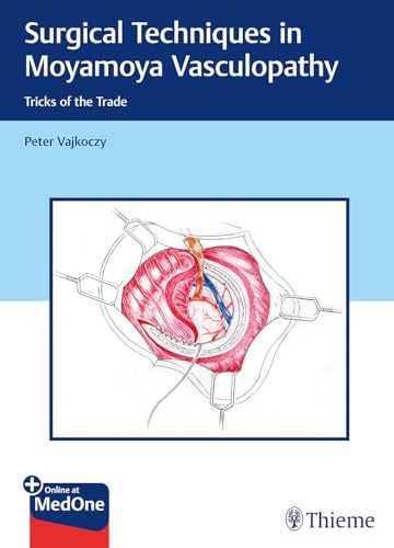 Surgical Techniques in Moyamoya Vasculopathy: Tricks of the Trade. Plus Online at MedOne