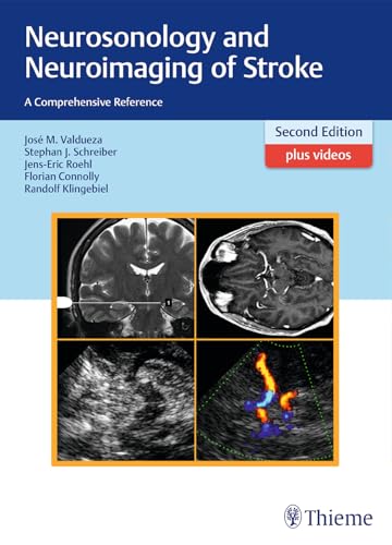 Neurosonology and Neuroimaging of Stroke: A Comprehensive Reference
