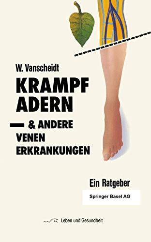 Krampfadern und andere Venenerkrankungen: Ein Ratgeber (Leben und Gesundheit)