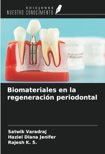 Biomateriales en la regeneración periodontal von Ediciones Nuestro Conocimiento