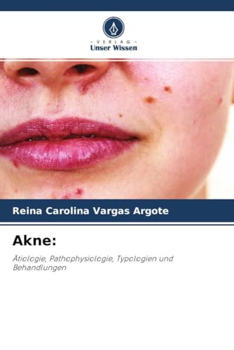 Akne:: Ätiologie, Pathophysiologie, Typologien und Behandlungen