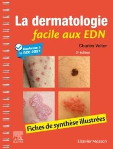 La dermatologie facile aux EDN: Fiches de synthèse illustrées La dermatologie facile aux EDN: Fiches de synthèse illustrées von MASSON