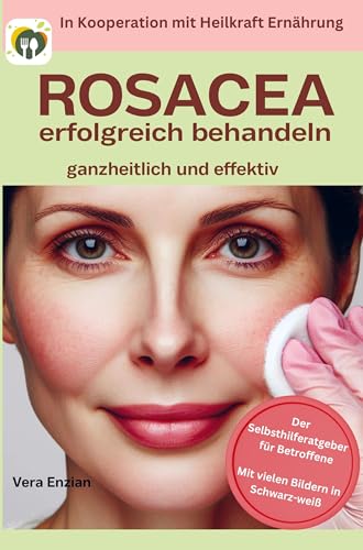 Rosacea erfolgreich behandeln - ganzheitlich und effektiv: Der Selbsthilferatgeber für Betroffene mit Tipps, die wirklich funktionieren