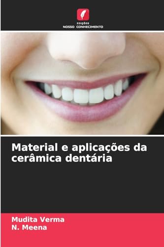Material e aplicações da cerâmica dentária von Edições Nosso Conhecimento