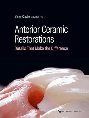 Anterior Ceramic Restorations: Details That Make the Difference von Quintessence Publishing