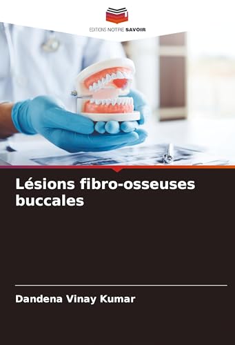 Lésions fibro-osseuses buccales: DE von Editions Notre Savoir