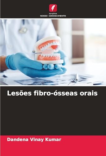Lesões fibro-ósseas orais: DE von Edições Nosso Conhecimento