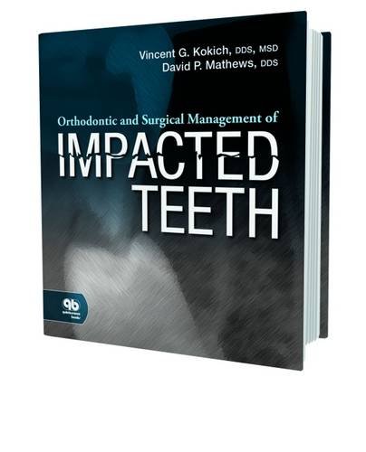 Orthodontic and Surgical Management of Impacted Teeth von Quintessence Publishing
