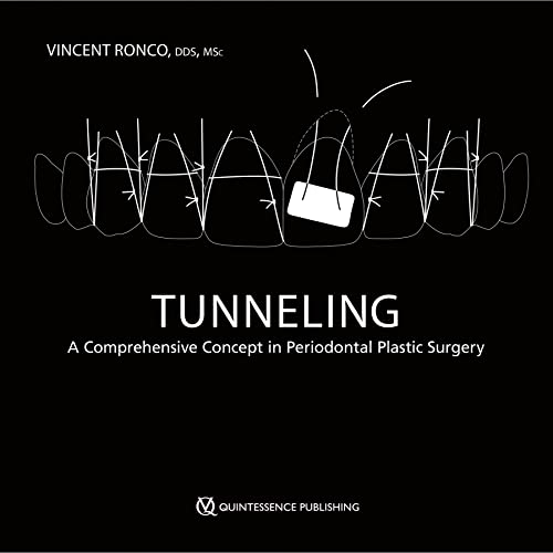 Tunneling: A Comprehensive Concept in Periodontal Plastic Surgery von Quintessence Publishing