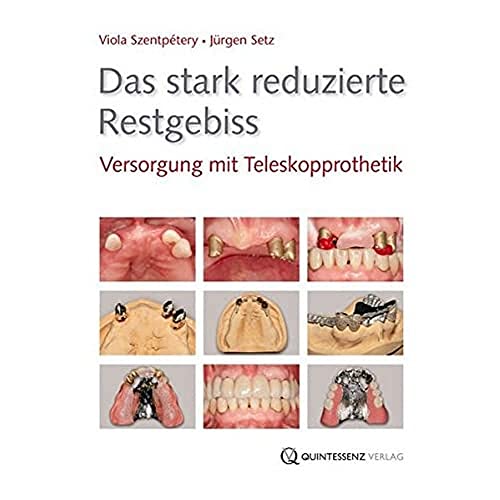 Das stark reduzierte Restgebiss: Versorgung mit Teleskopprothetik von Quintessenz Verlag