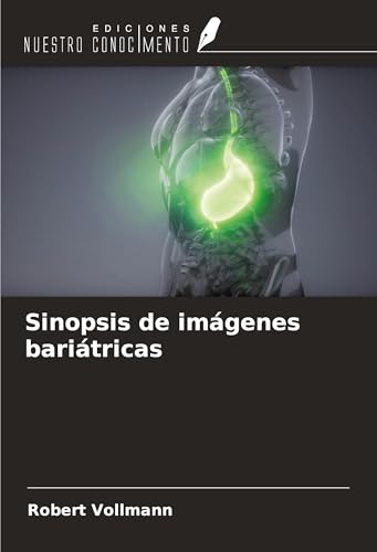 Sinopsis de imágenes bariátricas von Ediciones Nuestro Conocimiento