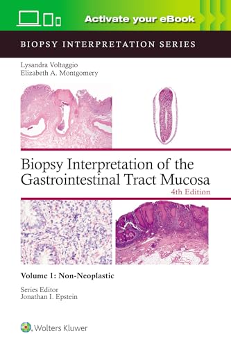 Biopsy Interpretation of the Gastrointestinal Tract Mucosa Volume 1: Non-Neoplastic: Print + eBook with Multimedia (Biopsy Interpretation Series, 1, Band 1) von Lippincott Williams & Wilkins