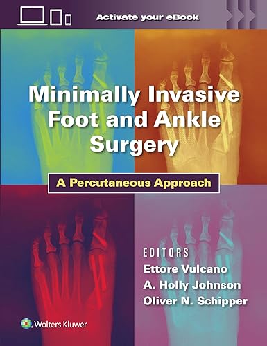 Minimally Invasive Foot and Ankle Surgery: A Percutaneous Approach von Lippincott Williams&Wilki