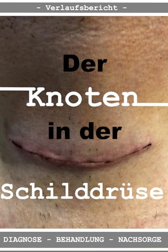 Der Knoten in der Schilddrüse: Diagnose - Operation - Nachsorge