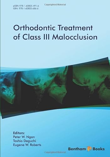 Orthodontic Treatment of Class III Malocclusion von Bentham Science Publishers
