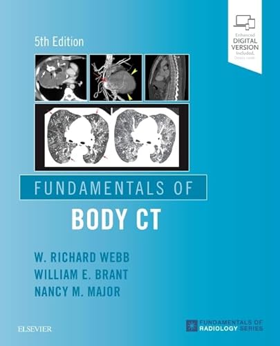 Fundamentals of Body CT (Fundamentals of Radiology) von Elsevier