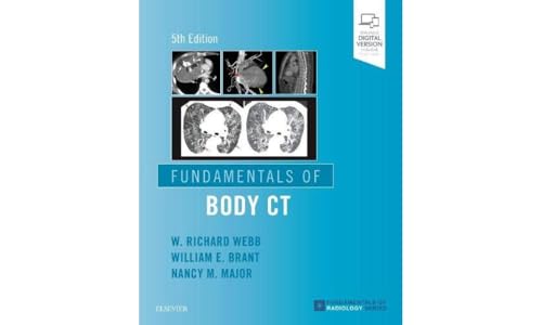 Fundamentals of Body CT (Fundamentals of Radiology) von Elsevier