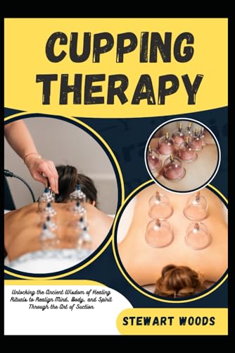 CUPPING THERAPY: Unlocking the Ancient Wisdom of Healing Rituals to Realign Mind, Body, and Spirit Through the Art of Suction von Independently published