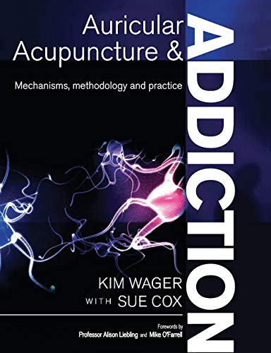 Auricular Acupuncture and Addiction: Mechanisms, Methodology and Practice