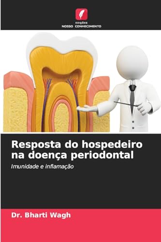 Resposta do hospedeiro na doença periodontal: Imunidade e inflamação von Edições Nosso Conhecimento