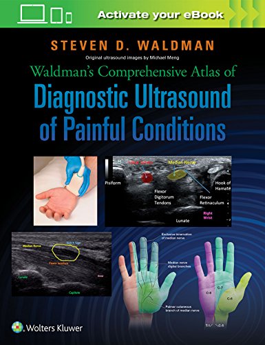 Waldman's Comprehensive Atlas of Diagnostic Ultrasound of Painful Conditions von Lippincott Williams&Wilki