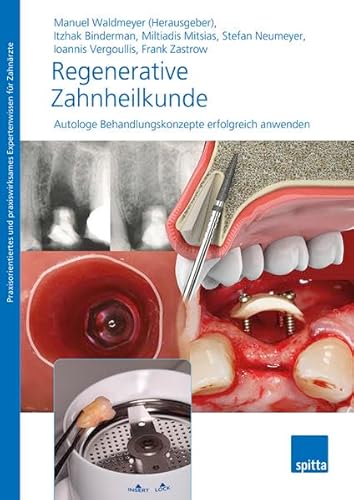 Regenerative Zahnheilkunde: Autologe Behandlungskonzepte erfolgreich anwenden