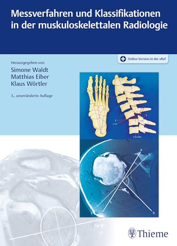 Messverfahren und Klassifikationen in der muskuloskelettalen Radiologie von Thieme
