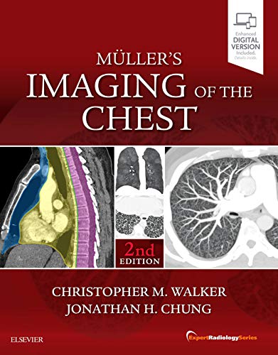 Muller's Imaging of the Chest: Expert Radiology Series von Elsevier