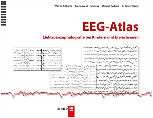 EEG–Atlas: Elektroenzephalografie bei Kindern und Erwachsenen von Hogrefe AG