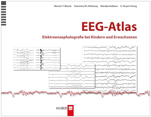 EEG–Atlas: Elektroenzephalografie bei Kindern und Erwachsenen