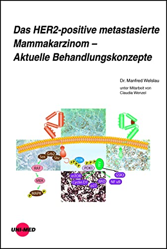 Das HER2-positive metastasierte Mammakarzinom – Aktuelle Behandlungskonzepte (UNI-MED Science)