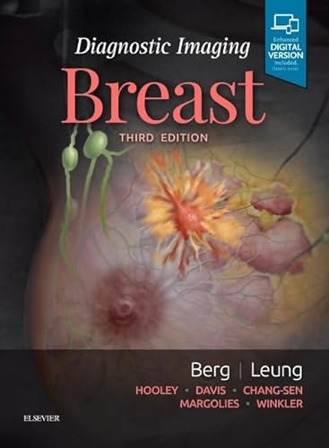 Diagnostic Imaging: Breast von Elsevier