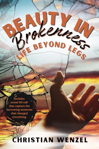 Beauty in Brokenness: Life Beyond Legs von Soel Love Books