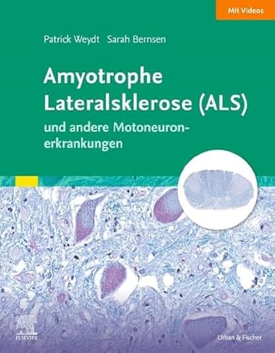 Amyotrophe Lateralsklerose (ALS) und andere Motoneuronerkrankungen: Das Wichtigste für Ärztinnen und Ärzte aller Fachrichtungen (Elsevier Essentials) von Elsevier