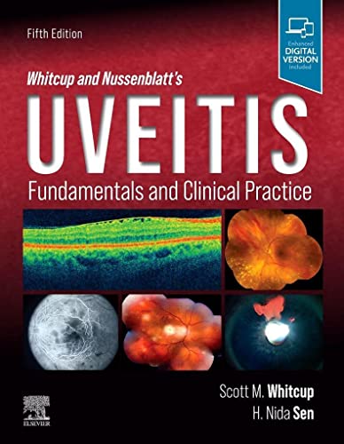 Whitcup and Nussenblatt's Uveitis: Fundamentals and Clinical Practice von Elsevier