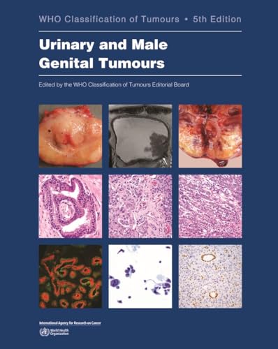 Urinary and Male Genital Tumours (Who Classification of Tumours)